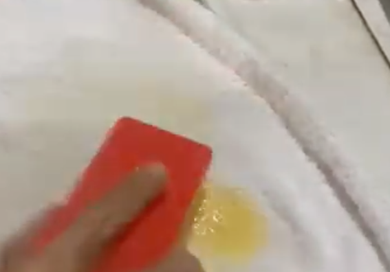 Muryatech Noda Darah dan Betadine